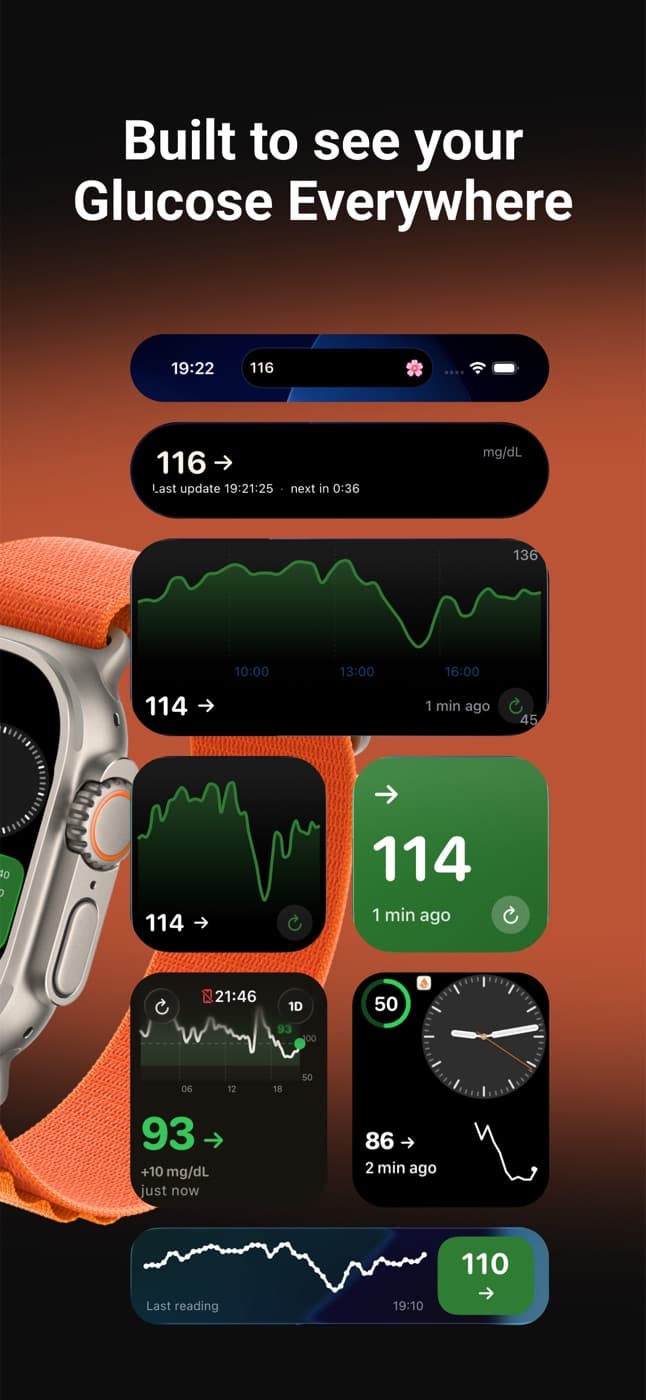 Widgets de Dulce: Dynamic Island, pantalla de bloqueo, pantalla de inicio y Apple Watch